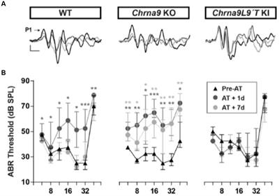 Genetic tools for studying cochlear inhibition